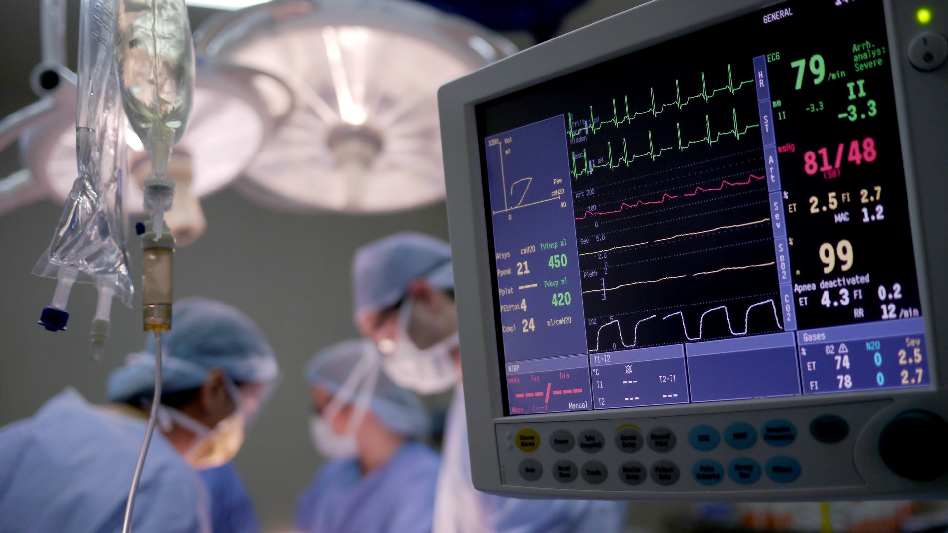 Hospital operating room with monitor and IV bag in foreground